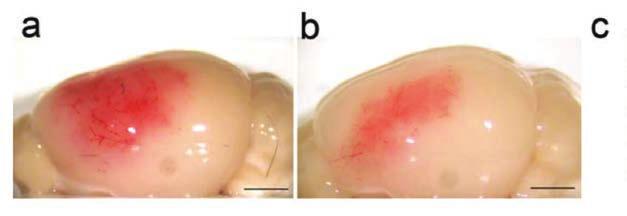 Figur 4. Blockering av PDGFR-α-signalering med imatinib reducerar intracerebral blödning i en experimentell strokemodell (MCAO, Middle Cerebral Artery Occlusion).