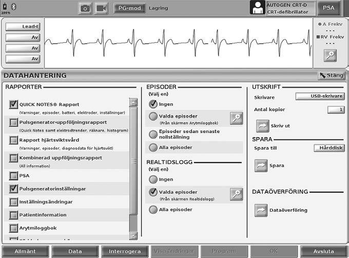 Anslut programmeraren endast till kända Bluetooth -enheter eftersom patientdata annars kan överföras till olämpliga skrivare eller enheter.