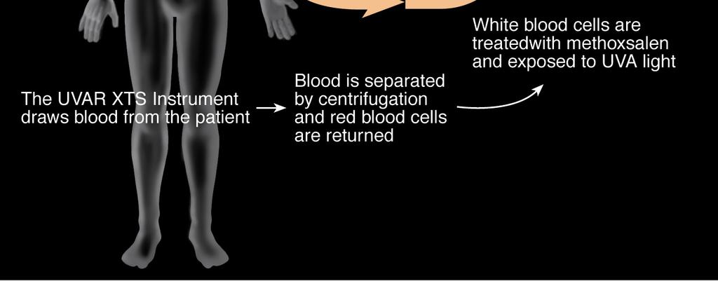 with UVA light The UVAR XTS Instrument draws blood from the patient Blood is