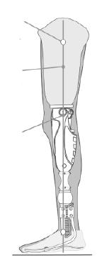 Protesknäleder Mauch Knee Protesknäleder InStÄllnIng av MaUCH Knee SVenSKa justering av stabilisering justering av svingfaskontroll