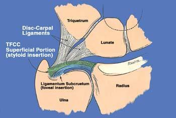 TFCC Triangulära fibrokartilaginösa komplexet ligament