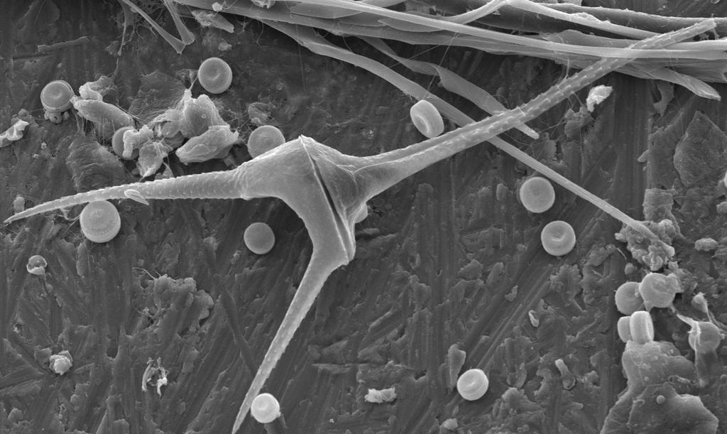Växtplankton En detaljerad beskrivning av årets mätresultat gällande växtplankton i sjöar finner Du på föreningens hemsida, www.dalalvensvvf.se. Nedan sammanfattas resultaten i korthet.