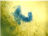 stained resting spores and secondary plasmodia in