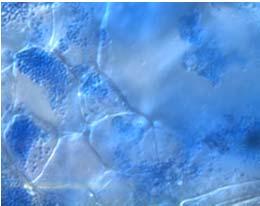 Primary plasmodia? Secondary plasmodia?