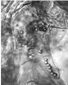 blue stained in host tissue.
