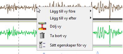 5.3 Plotdiagram Plotdiagram används för att visa mätparametrar som varierar längs spåret, exemplet här ovan visar hur höjdläget varierar längs med spåret.