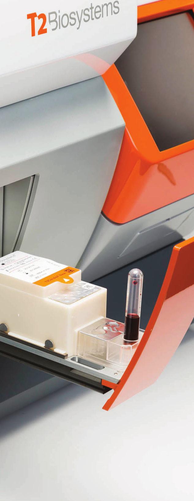 Försäljningsavtal med T2 Biosystems Biotech-IgG AB har distributionsrättigheter på de svenska, danska, norska, finska, isländska marknaderna för det diagnostiska T2Dx 1.