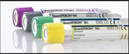 Diagnostik Sputumprov: Skickas till Lund (PCR och Odling) Blodprov: IGRA test (Quantiferon eller TB-spot) ger färre falskt positiva än PPD som tidigare användes.