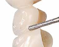 Although the main cutting and grinding Steg in the 1: Lila, haleine medium Son traitement est toutefois de très longue optimal dieses preparering Materials sehr utan aufwändig.