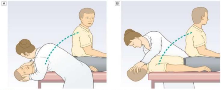 BPPV (Godartad lägesyrsel) Diagnostik Dix Hallpike test Patienten sitter upp, huvudet vrids 45 grader mot det öra som skall undersökas Patienten läggs snabbt (max 2sek) ned på rygg, huvudet skall