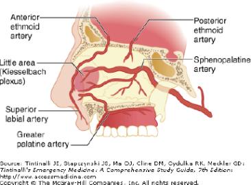 Näsblödning (epistaxis) Orsaker Trauma Slemhinneförändringar (infektion,