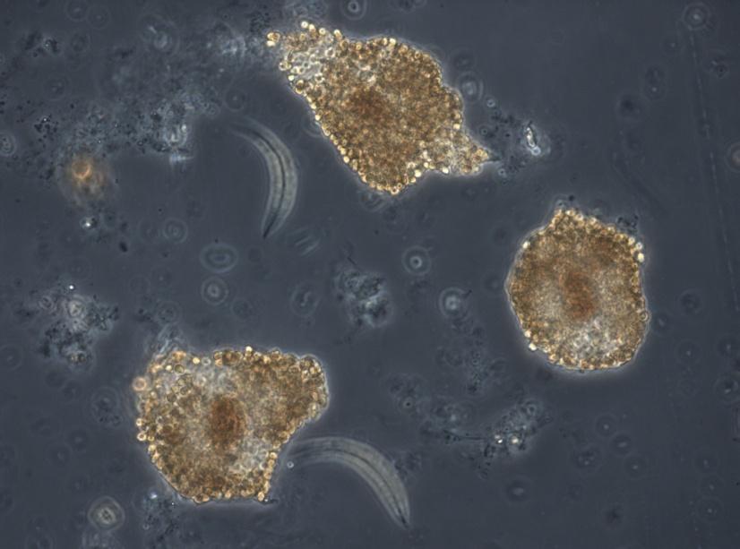 Figur 3. Massförekomst av nålflagellaten Gonyostomum semen (bruna celler) i Hagserydssjön 2008. Huvuddelen av sjöarna hade en mycket liten eller liten biomassa vid provtagningen i augusti 2008.