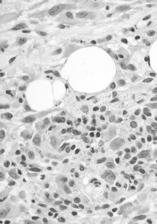 exakt cancerdiagnostik.