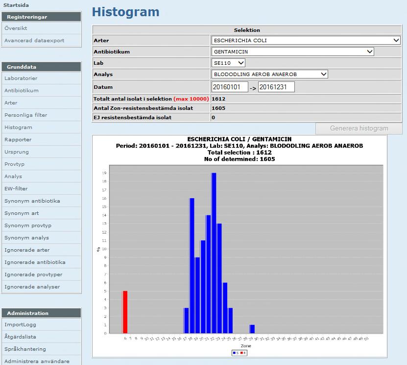 Histogram Sid