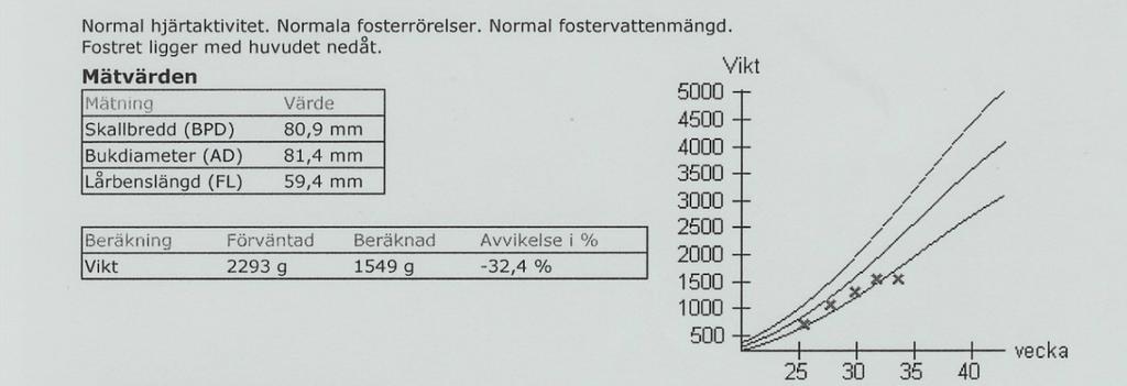 Tolkning