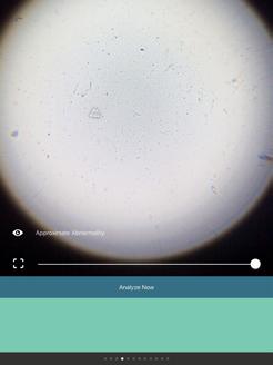Fyll i avvikelser och eventuell spädningsratio, tryck sedan på Analyze Now.