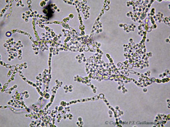 Candida albicans-svamp Candida finns i den slidan, kan aktiveras vid föränding av miljön.