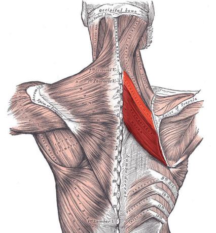 Spänd eller förkortad muskel kan ge: Svårigheter att arbeta med händerna högt över huvudet Smärta i axelleden Smärta eller värk i ländryggen M. Rhomboideus Major och Minor M.