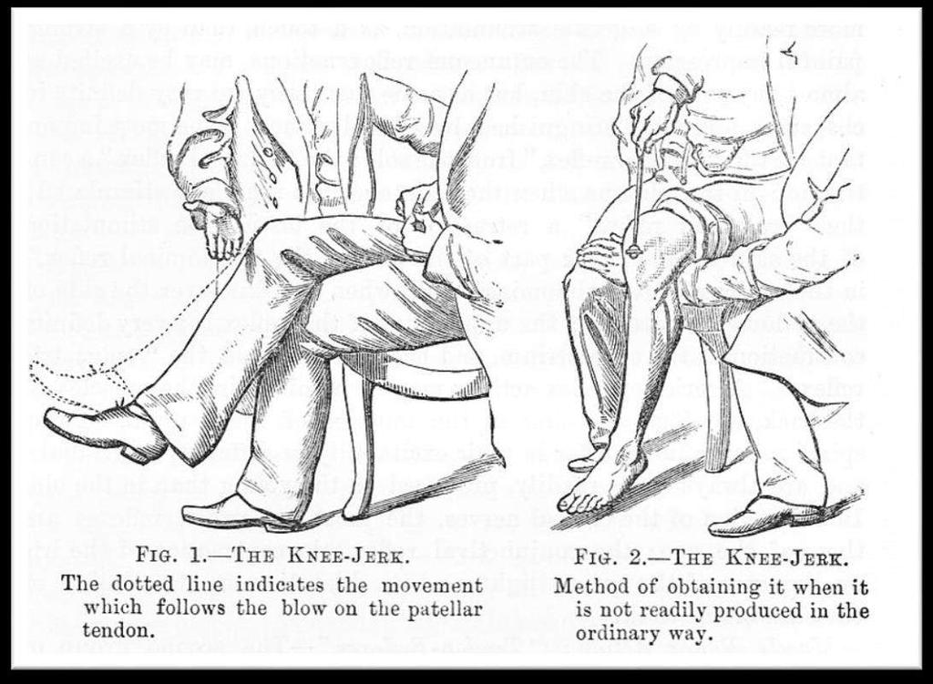 W.R. Gowers (1886) Ofta finns ( ) depression; det kan vara svårt att säga om detta är mer än det naturliga