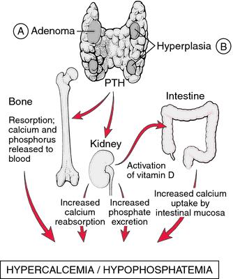 Parathormon fysiologi Ben PTH Tarm Benresorption; frisättning av kalk och fosfat till blod Njure Aktivering av