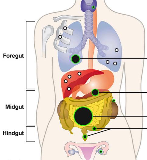 endokrina organ Tyreoidea