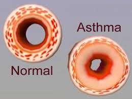 + Astma: trånga luftrör och segt slem Beta -2 stimulerare Salbutamol, Ventoline, Airomir, Terbutalin, Bricanyl Bronkvidgande Mucociliärt clearance transport av segt slem Adrenalin Avsvällande
