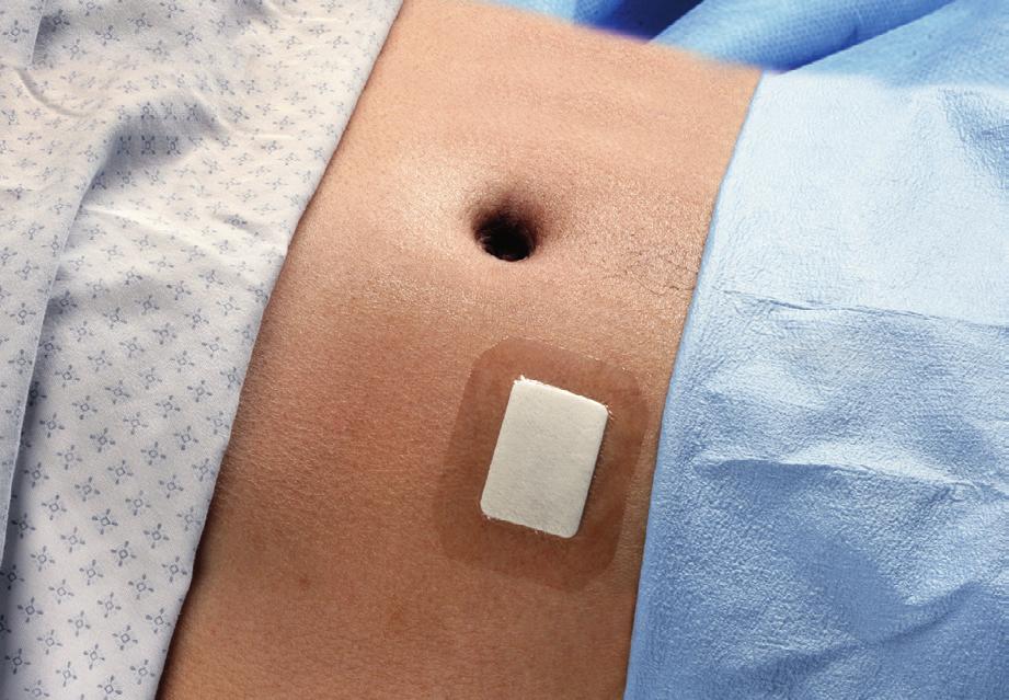Finland: Finlands officiella rekommendationer för sjukhushygien/ förebyggande av infektioner; Titel: Förebyggande av infektioner med avseende på patientvård: Publicerad 2010 Helsinki/ Finland av