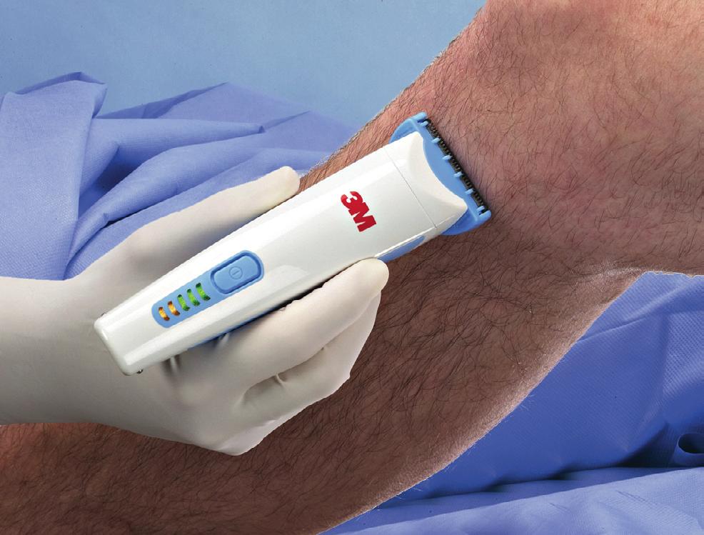 Preoperativ hårborttagningsteknik Preoperativt Evidens Hårborttagning med håravkortningssapparat ger 3 gånger färre postoperativa sårinfektioner jämfört med rakhyvel.
