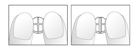 Lägg tabletten på en jämn, hård yta (t.ex. ett bord eller en arbetsbänk), med krysskåran uppåt. Tabletten delas genom att pressa på den med båda pekfingrar längs brytskåran (bild 1 och 2).
