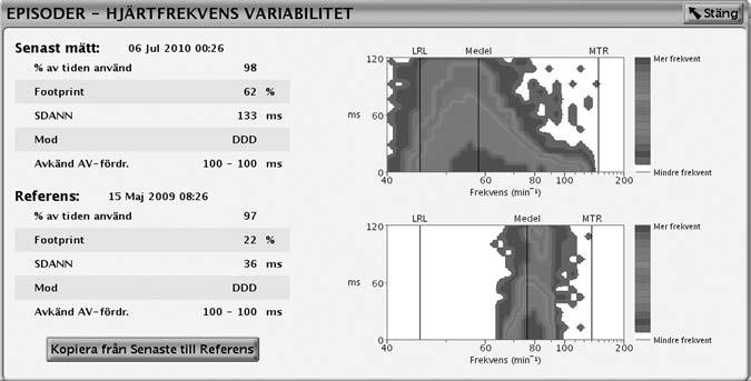 Patientdiagnostik och Uppföljning Räknare 4-11 Det HRV som mäts genom SDANN och HRV Footprint är ett objektivt fysiologiskt mätvärde med hjälp av vilket hjärtsviktspatienter med högre risk för