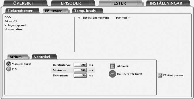 5-2 Elektrofysiologiska tester EP-testfunktioner EP-TESTFUNKTIONER Skärmen EP-test Med hjälp av EP-testerna kan du noninvasivt inducera och bryta arytmier.
