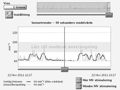 2-40 Stimuleringsbehandling Sensorstyrd stimulering och Sensortrender Figur 2 28.