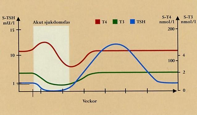 NON THYROIDAL ILLNESS (NTI), TIDSFÖRLOPP Vid