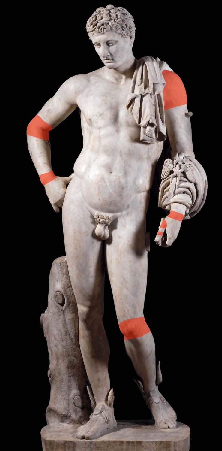 Arthritis The Farnese Hermes The