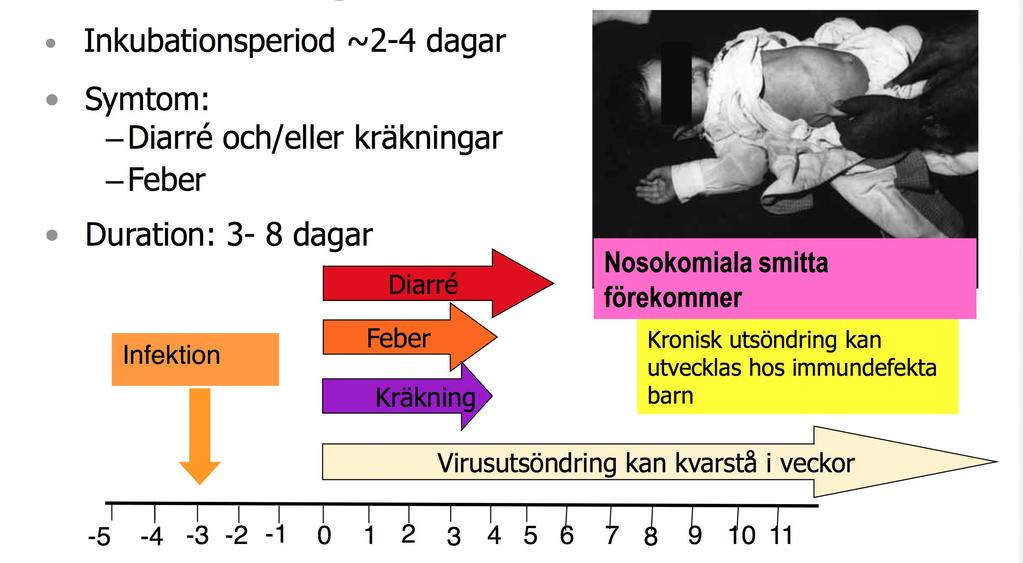 Rotavirusinfektion klinik