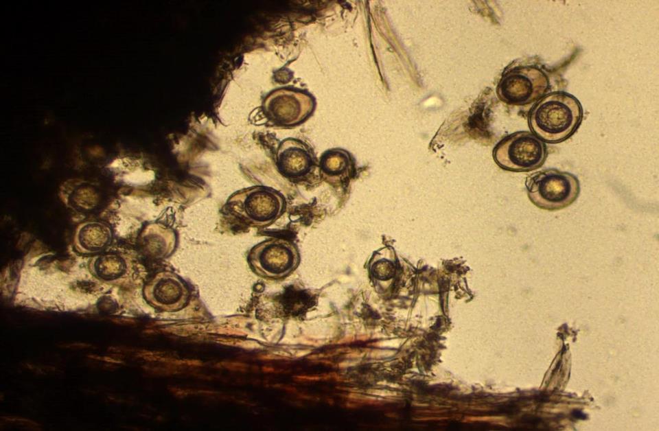 Vilsporer av Phytophthora pisi i rötter