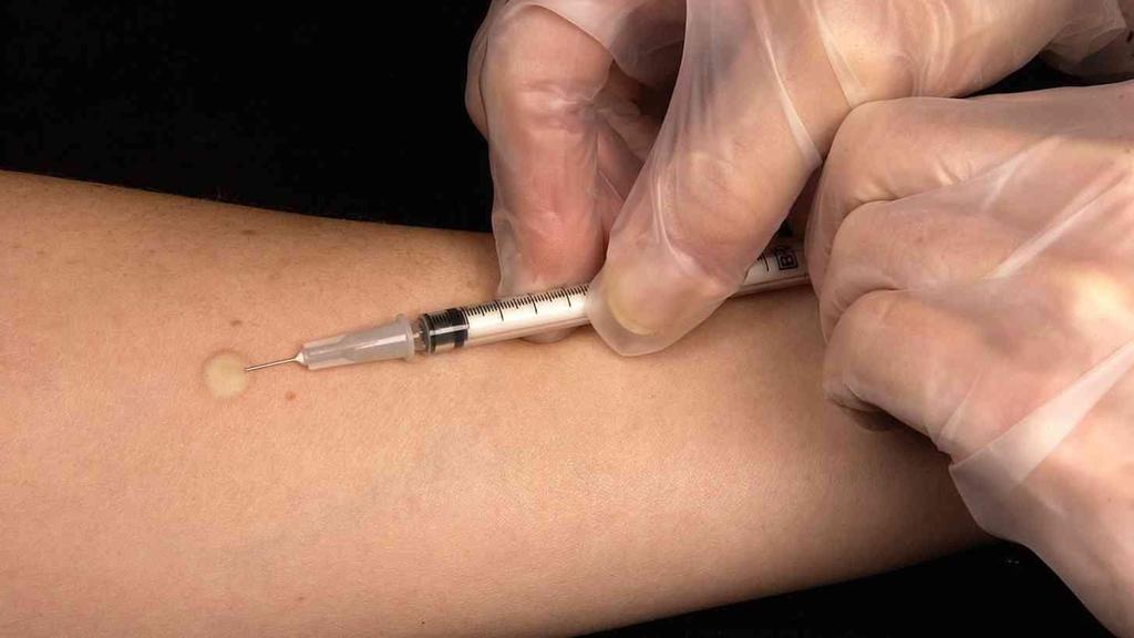 Dos och vaccinationsteknik - Barn över 12 månader (och även vuxna): 0,1 ml vaccin - Barn under 12 månader: 0,05