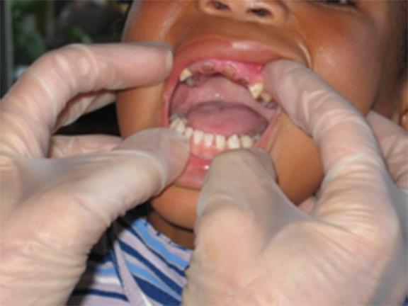 december 2007 i kåkstaden Khayelitsha. Tandkliniken fick namnet Philani Dental Clinic då den var lokaliserad hos organisationen Philani Nutrition Trust i Khayelitsha.