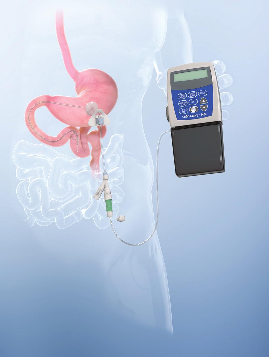 16 h DUODOPA PATIENT POCKET