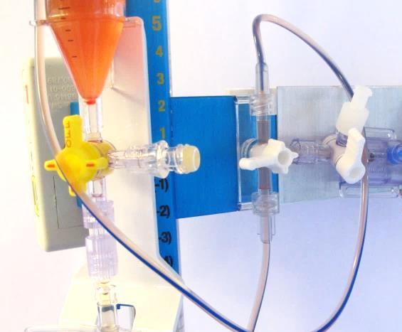 TRYCKMÄTNING MED ÖPPET V-DRÄN ICP-värdet avläses utan att stänga trevägskranen mot dränagebehållaren (flack tryckkurva på monitor).