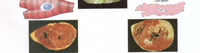 with triphenyltetrazolium chloride (an enzyme