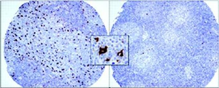 cellens CD20 antigen