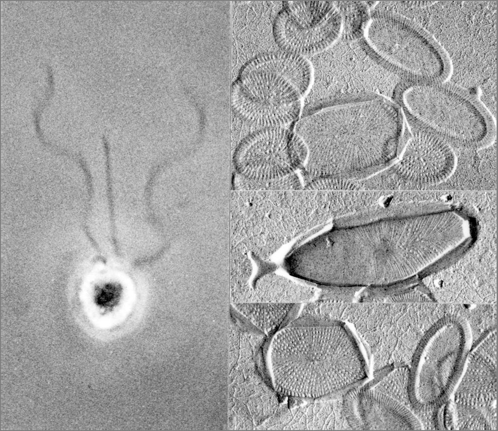 Prymnesium polylepis, i media kallad mördaralgen, orsakade sommaren 1988 stor förödelse i Västerhavet. Bilden visar hur algen ser ut i ljusmikroskop.