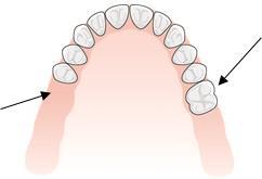 91 5061 5062 Mobila tänder vid parodontit med behov av stabilisering 5071 5072 Dysfunktionell ocklusion 5443 5449 Skador och komplikationer vid protetiska konstruktioner 5450 5451 Tillstånd i samband