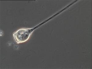 BIOSTEGETS MIKROBIOLOGI Ciliater Ciliater