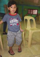 Nu kan Prince Jared gå han fick hjälp med en operation Filippinerna En av förskoleeleverna i Bataan, bärs av sin pappa till skolan varje dag.