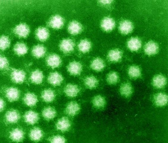 Calicivirus Symtom: Illamående, kräkningar, diarré, buksmärtor, ibland låggradig feber,