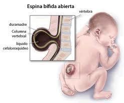 afferent input etc Stroke,