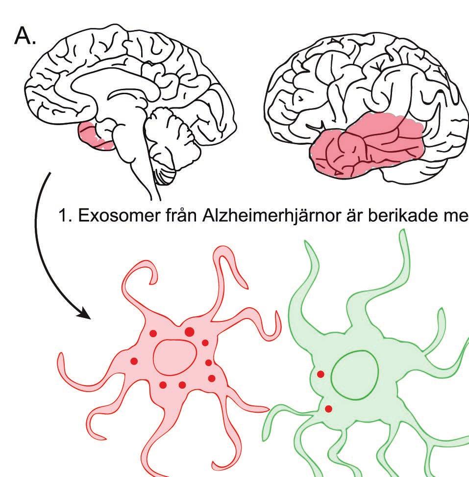 Alzheimers Exosomer kan produceras och frisättas av praktiskt taget alla celler i kroppen och finns i stort antal i de flesta kroppsvätskor såsom blod, urin, saliv och cerebrospinalvätska. len.