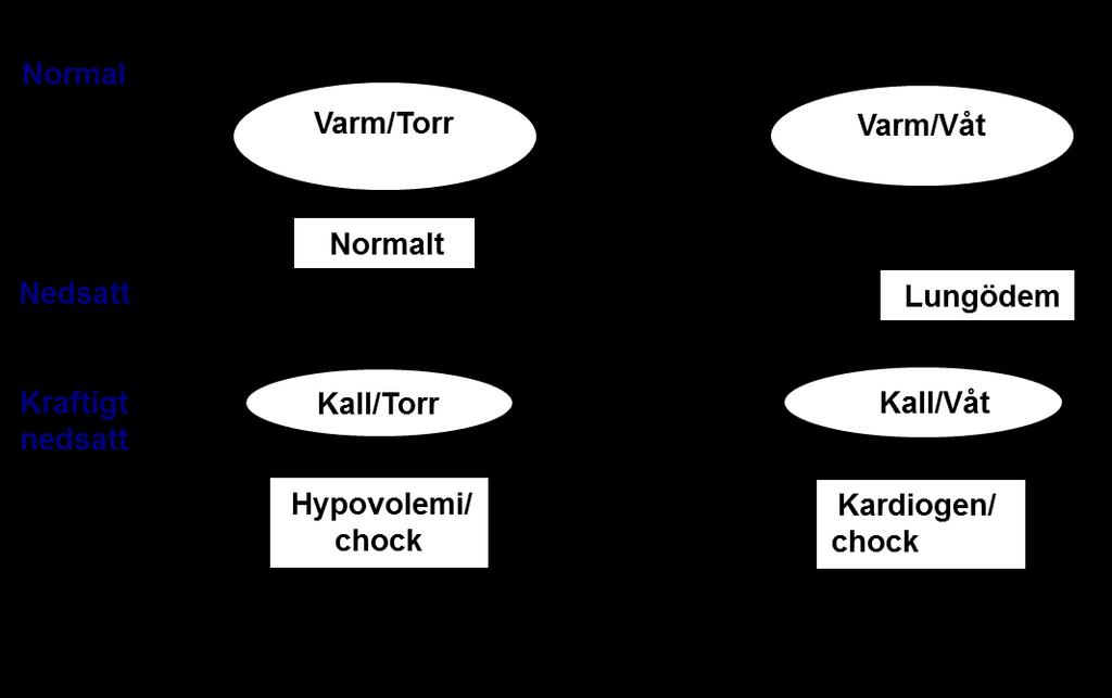 Akut hjärtinfarkt är vanligaste orsaken till akut hjärtsvikt. Vid akuta koronara syndrom och hjärtsvikt är snar koronarangiografi och intervention indicerad.